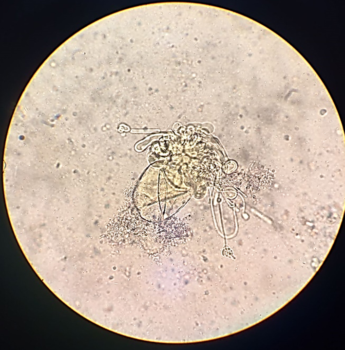 Estructura observada en una muestra de heces de una niña de 10 años, montaje en fresco, teñido con Lugol al 5% y compatible con Urbanorum spp (objetivo 40X)
